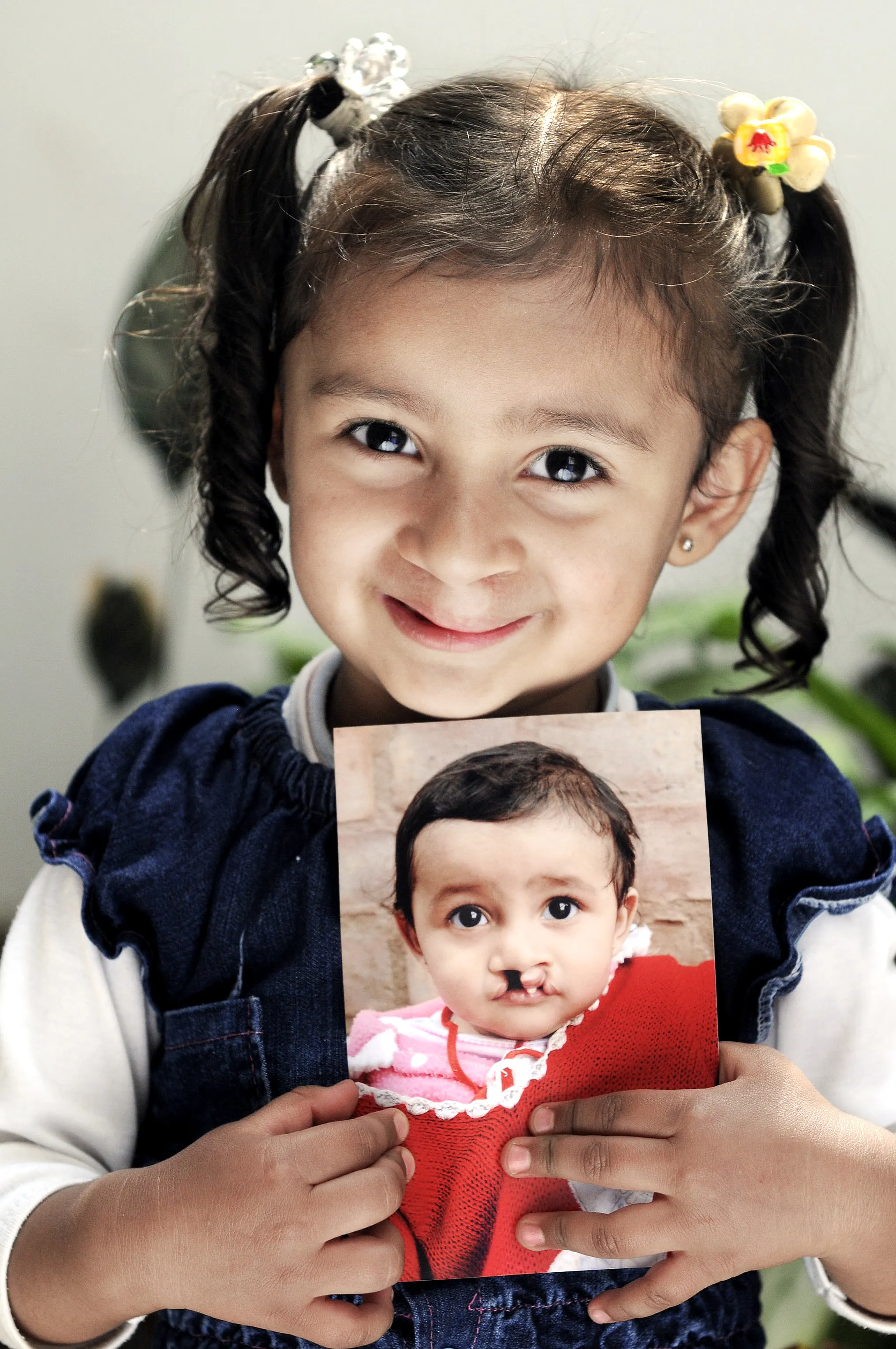 Laura holds her before photo after surgery.