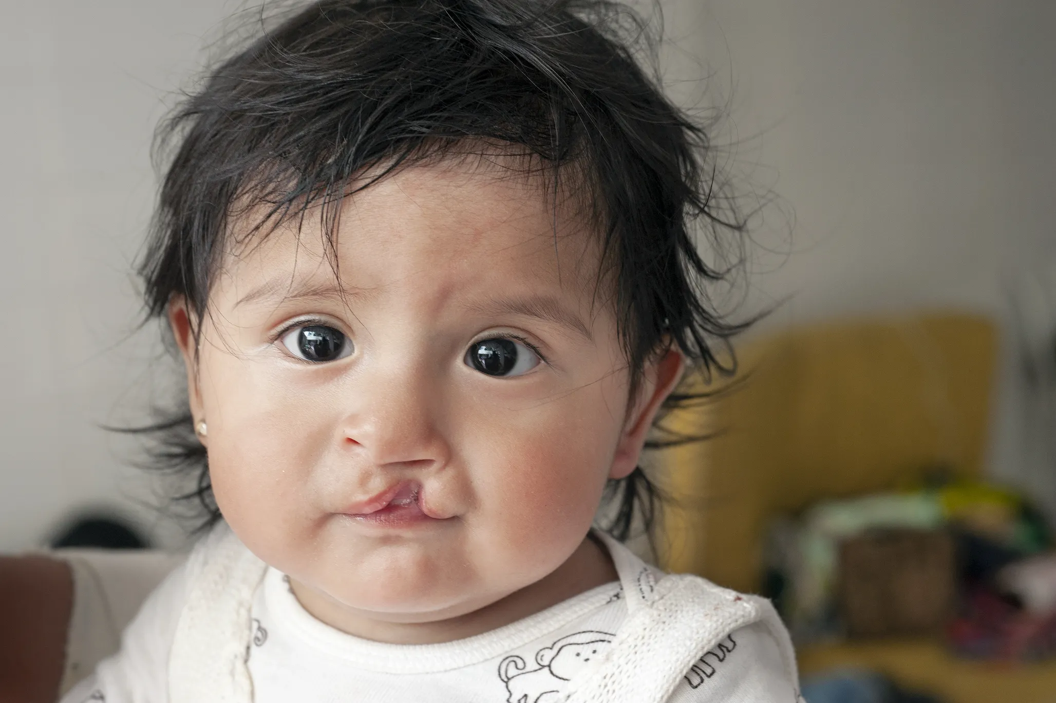 Heydi, before surgery.