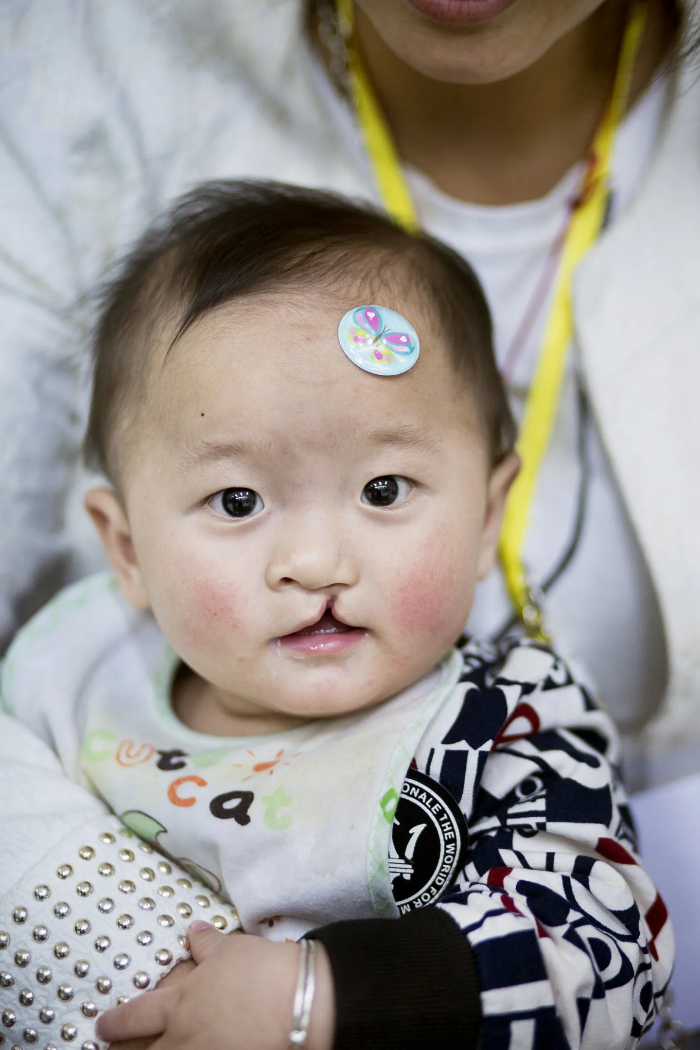 Yi Miang looks at the camera before surgery in 2016.