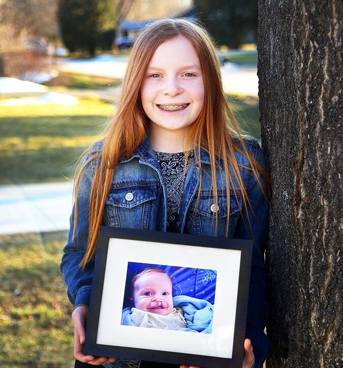 Elizabeth smiles with a photo of her as a baby, before her cleft surgery.