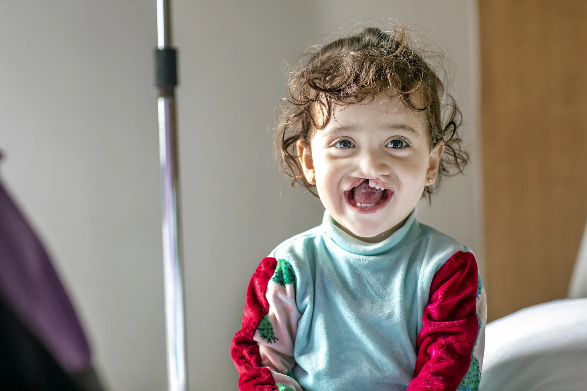 Janat, now almost 2 years old, shares her biggest smile during screening at Operation Smile Morocco’s October 2021 surgical program in Casablanca.