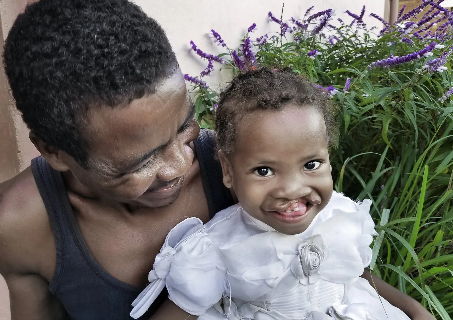 Brunel, before surgery, shares a smile with her father.