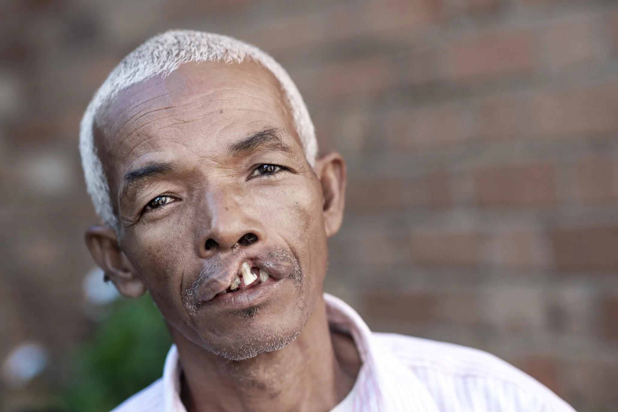 Meet 52-year-old Alfred.