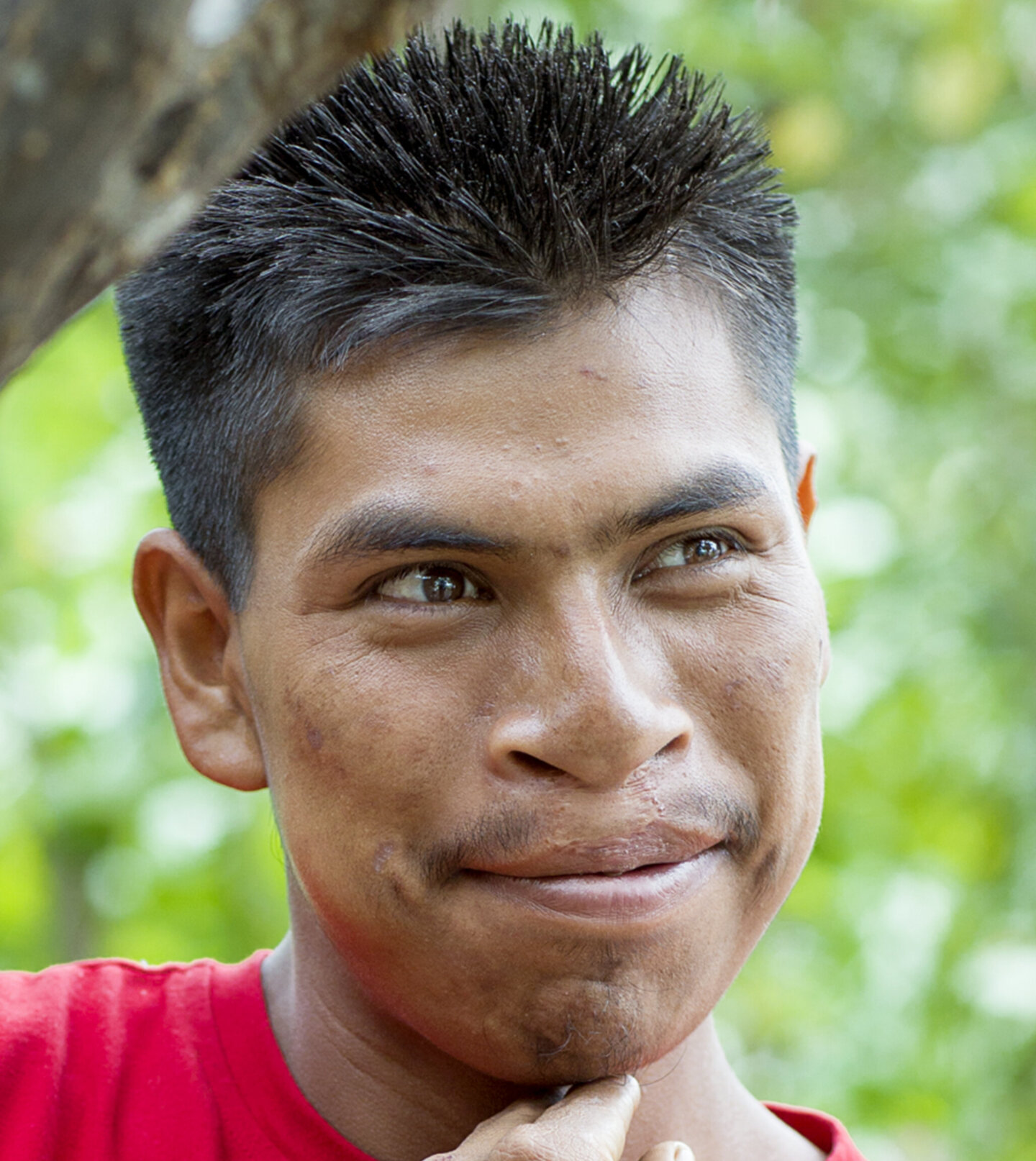 Virgilio, after surgery.