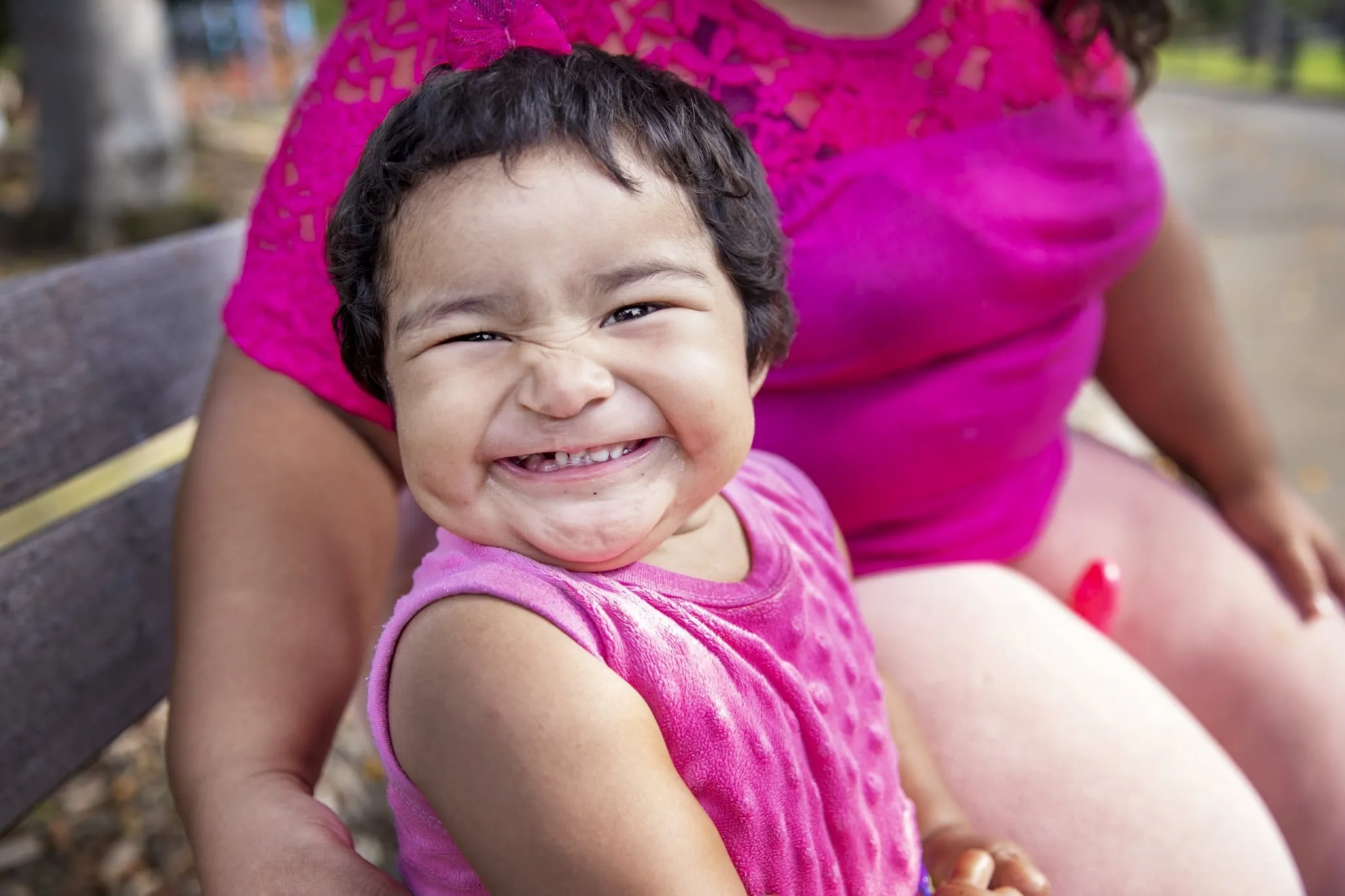 Lilia, after surgery.