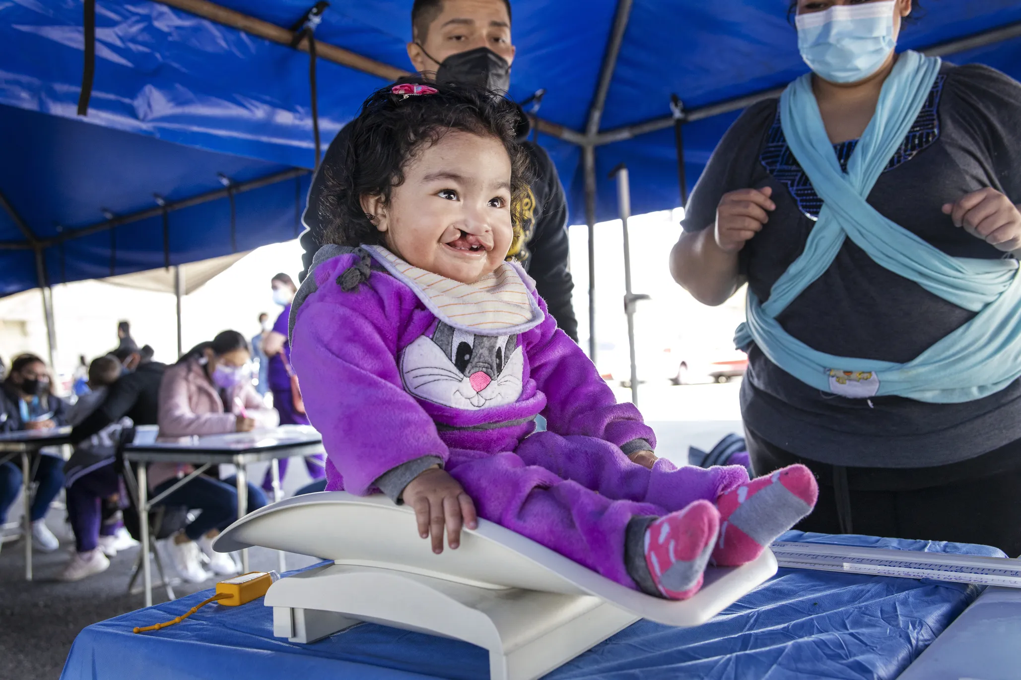 Lilia is examined by Operation Smile volunteers during a surgical program in Puebla, Mexico.