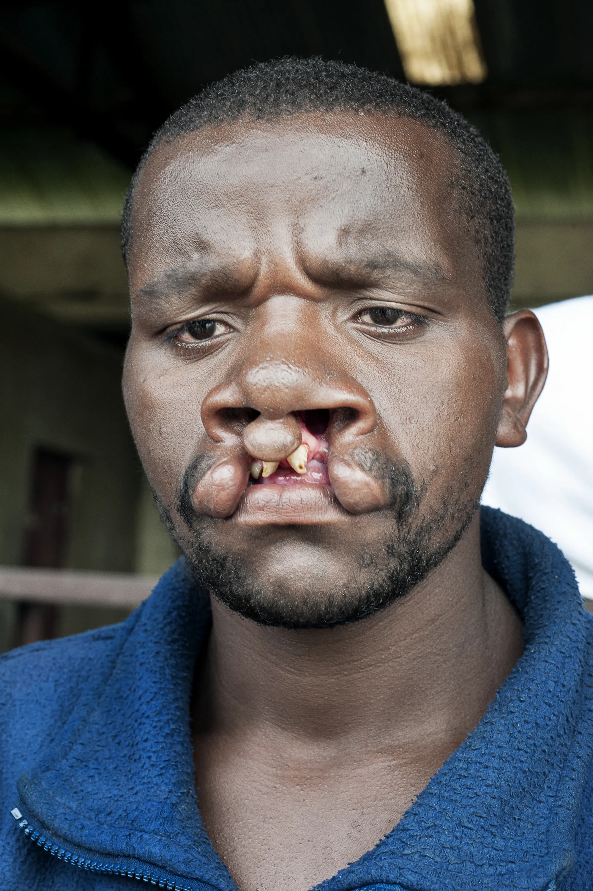 Enok, before surgery.