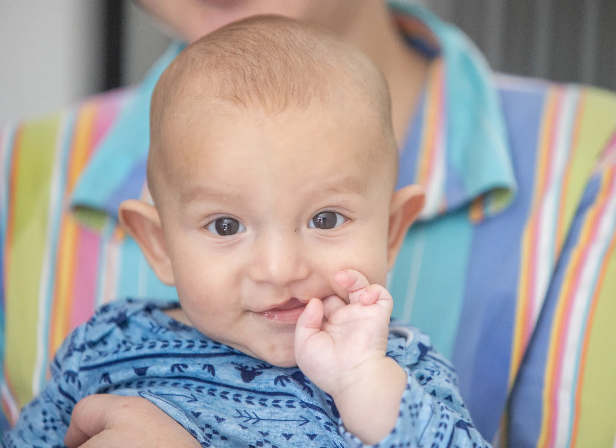 Samuel looks at the camera before his surgery at a surgical program in Guatemala.