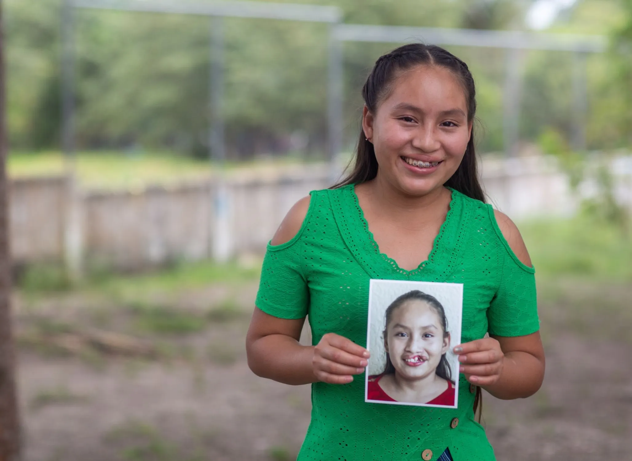 Dayana holds her before photo.