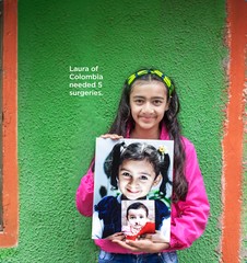 Laura of Colombia needed 5 surgeries.