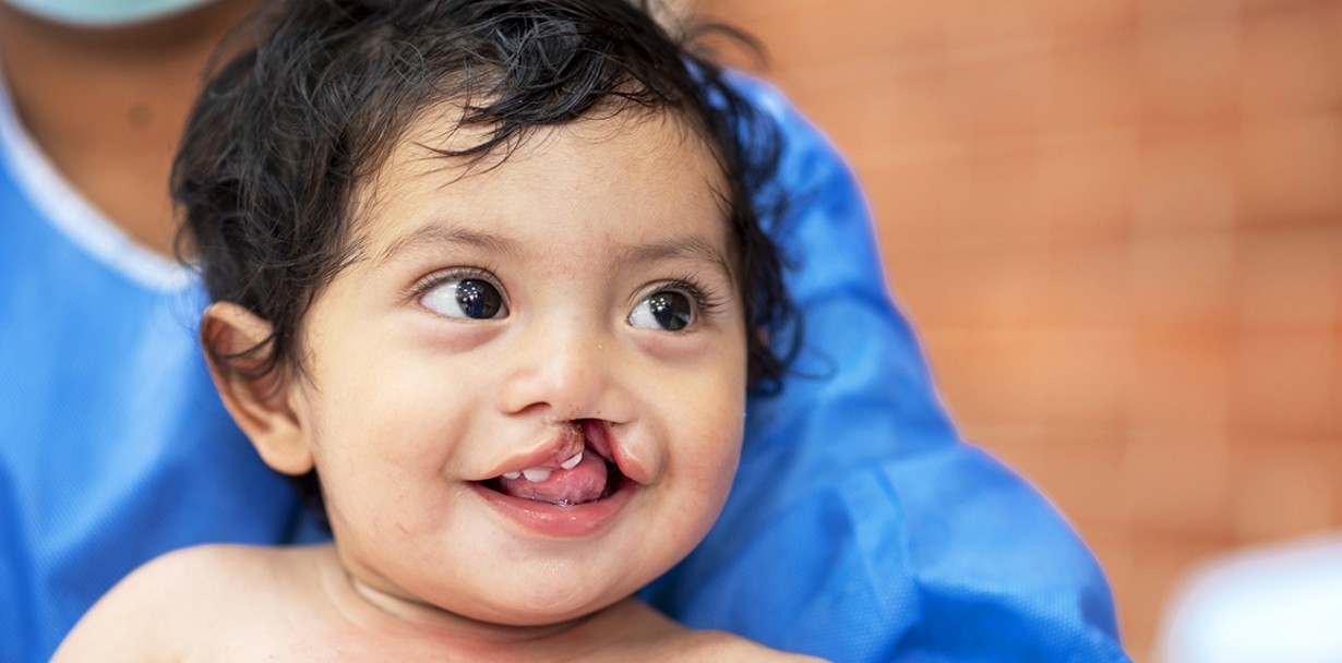 Alongside with his mother, Carmelina, 10-month-old Juan Elias was examined by volunteer dentist Dr. Vilma Arteaga at screening during Operation Smile Guatemala’s May 2021 medical mission​ in Guatemala City. Juan Elias, who was later deemed healthy enough to undergo surgery, was one of 26 patients to receive comprehensive health evaluations. Photo: Rohanna Mertens.
