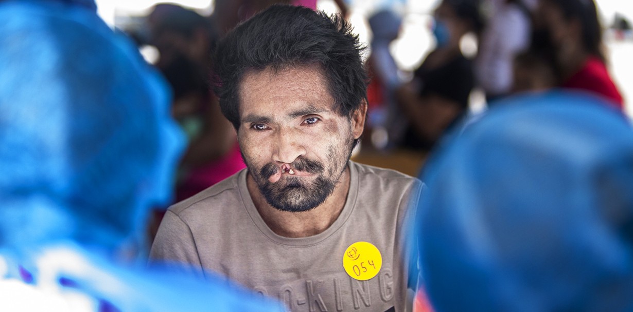 Surrounded by a sea of blue blurred out volunteers during screening, 38-year-old Adelmo arrives to the surgical program alone, hoping to leave with a new smile that he's waited his entire life for.