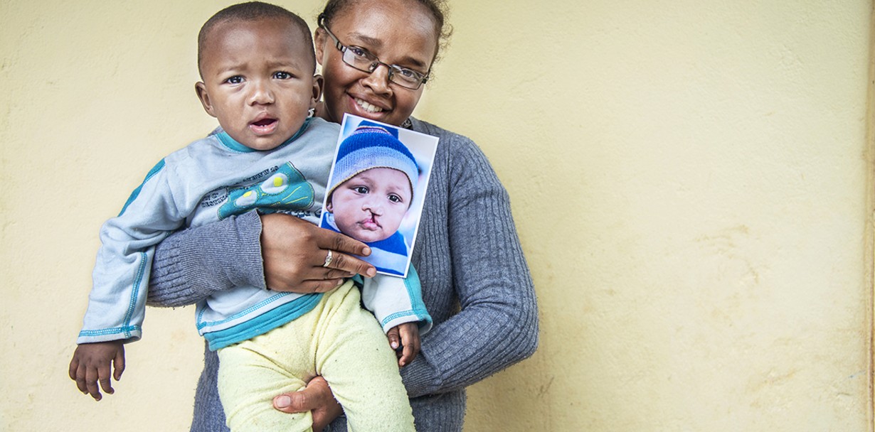 Tiavina and his mom, Denise, pose for a photo one year his surgery.