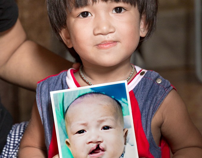 Wearing a red and blue tank top, 3-year-old Folksong holds his before image as he looks at the camera. 