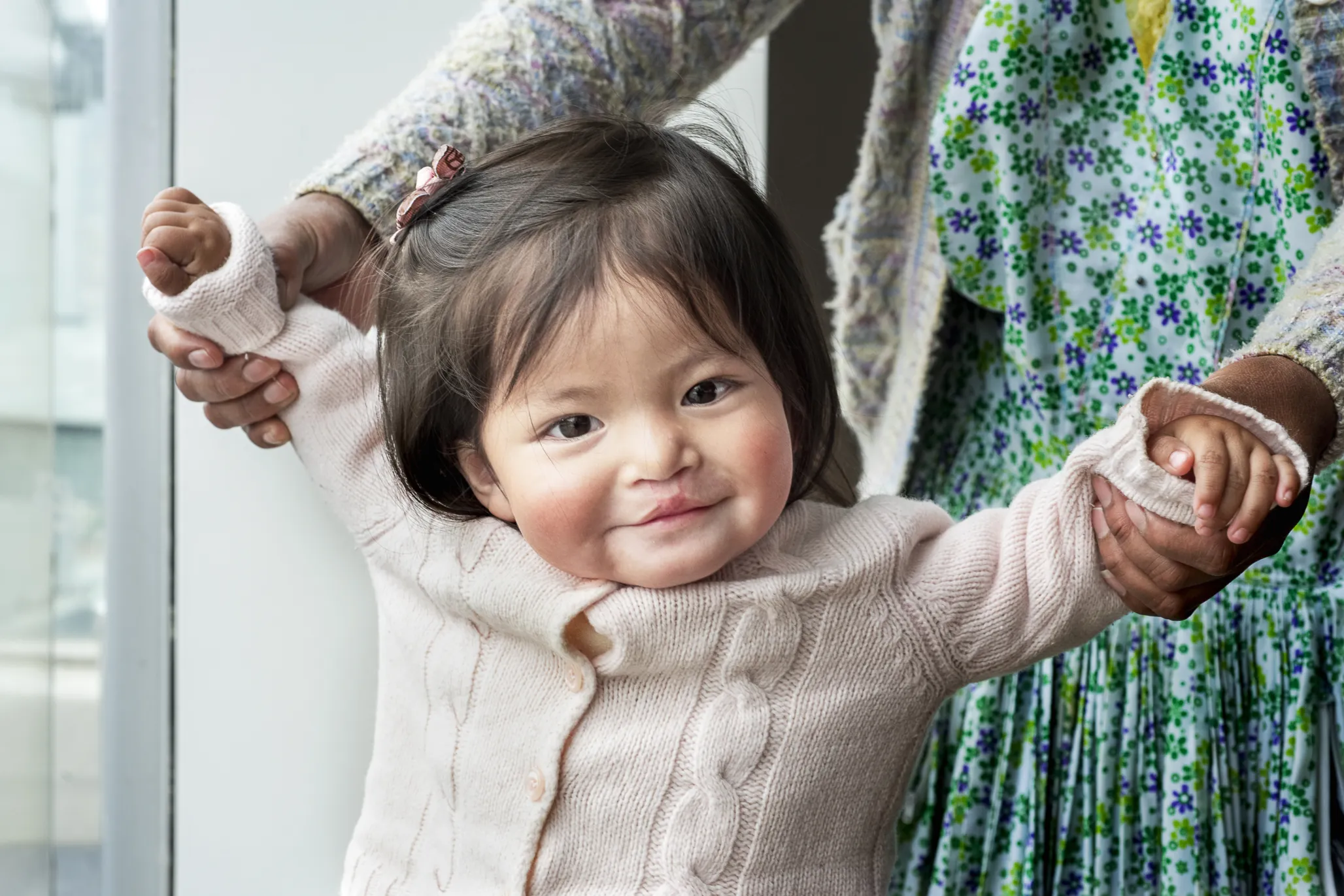 Annika looks at the camera after receiving her cleft surgery at 8 months old.