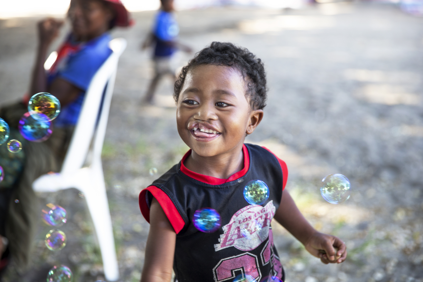Leana, 2 years old, plays with bubbles at a surgical program in Madagascar.