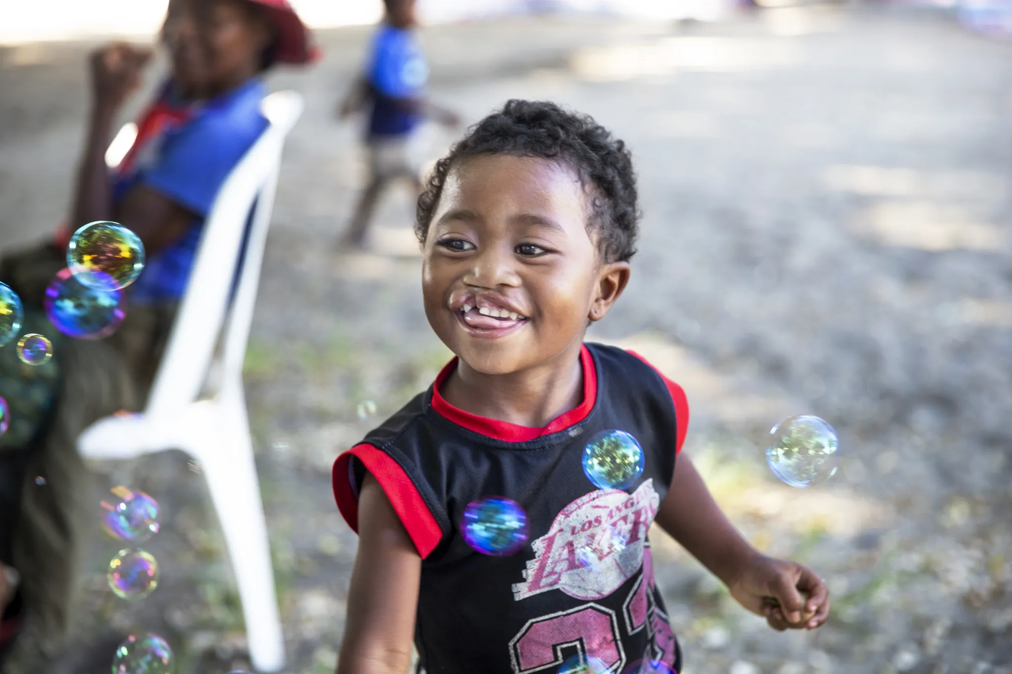 Leana, 2 years old, plays with bubbles at a surgical program in Madagascar.