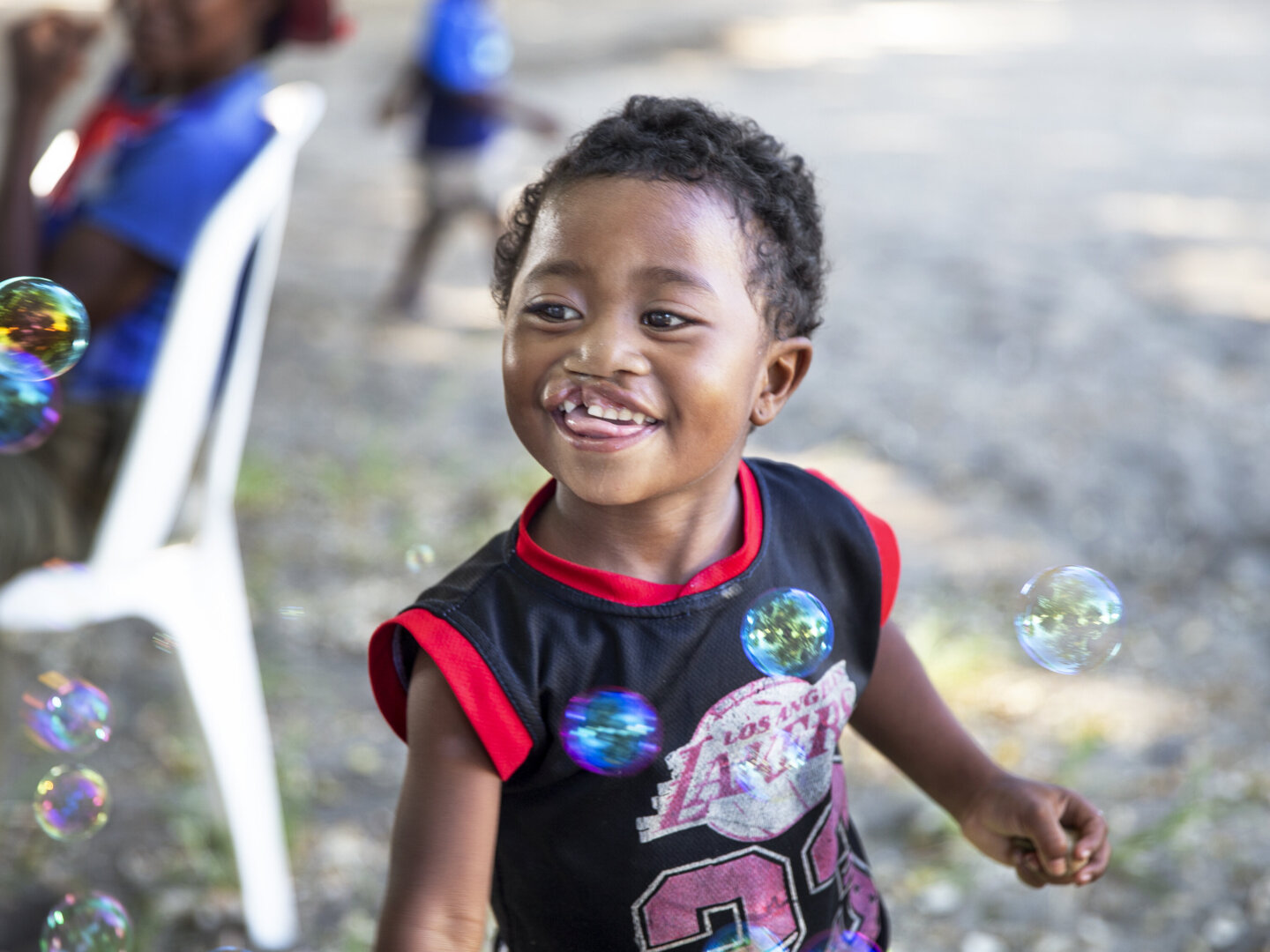 Leana, 2 years old, plays with bubbles at a surgical program in Madagascar.