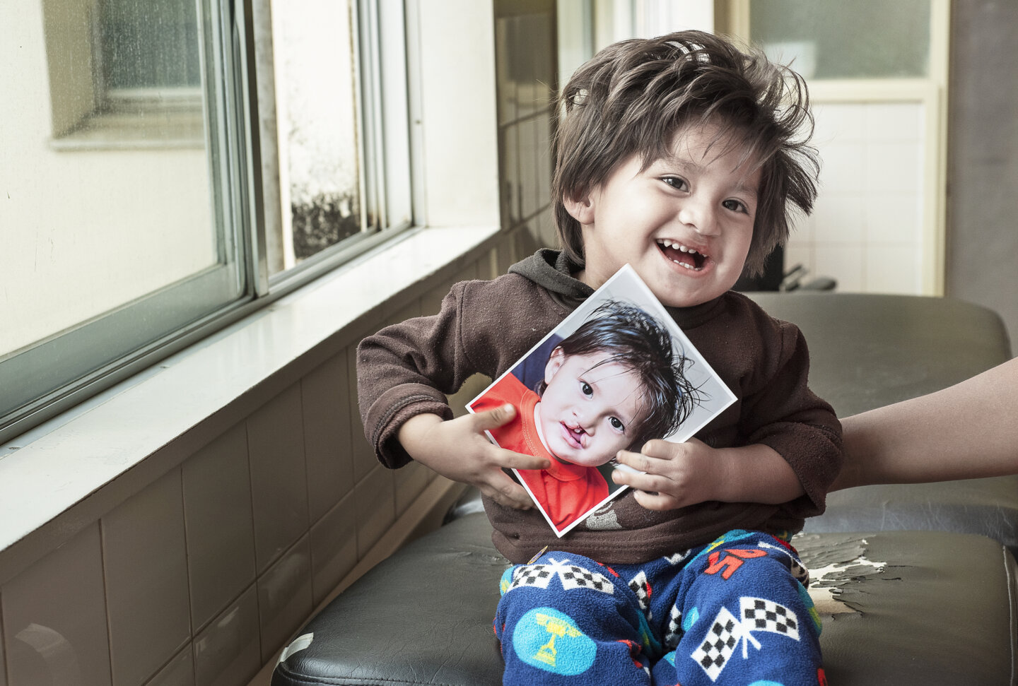 Damian, after surgery.