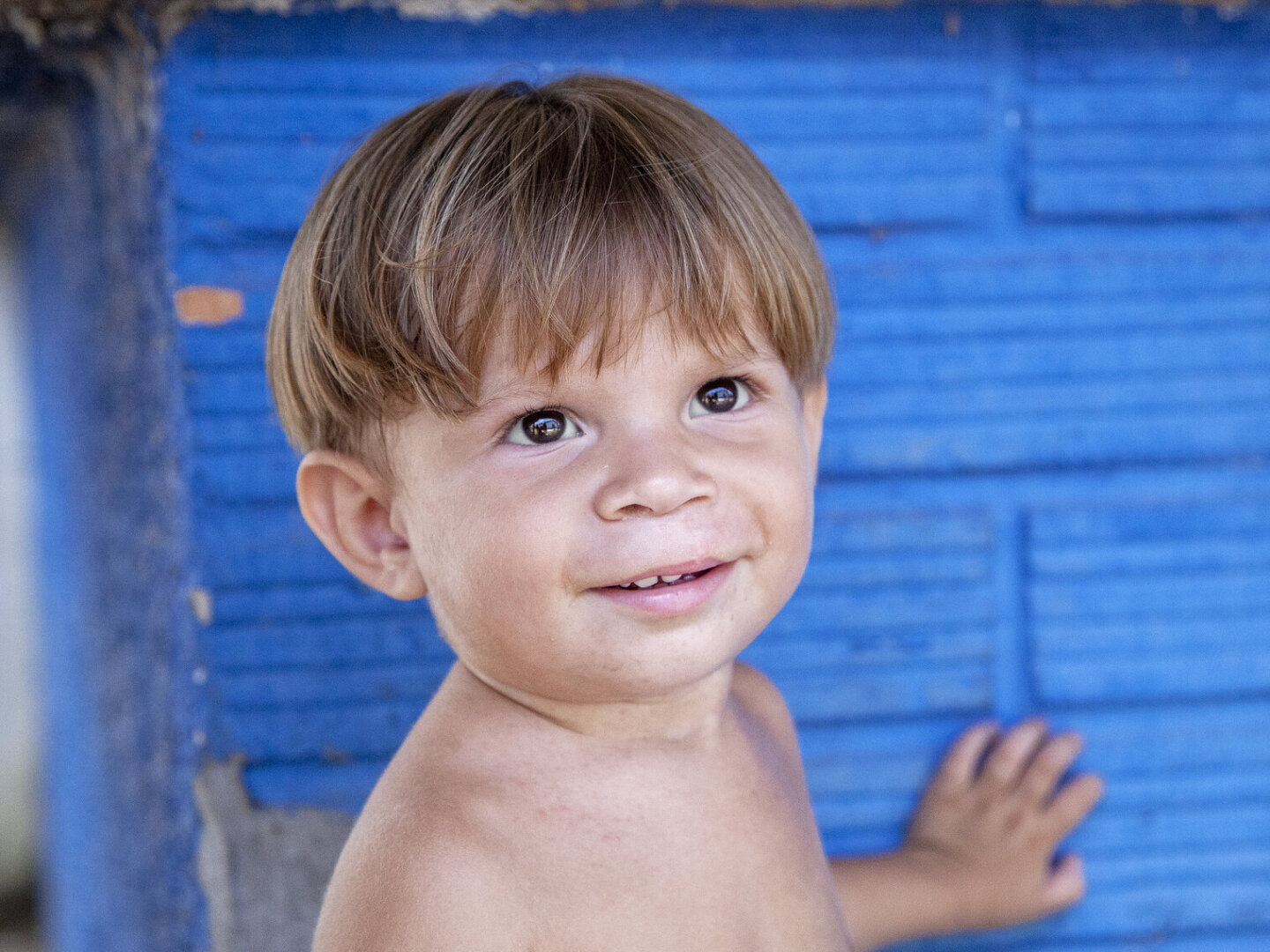 Fredy, one year after his cleft lip surgery.