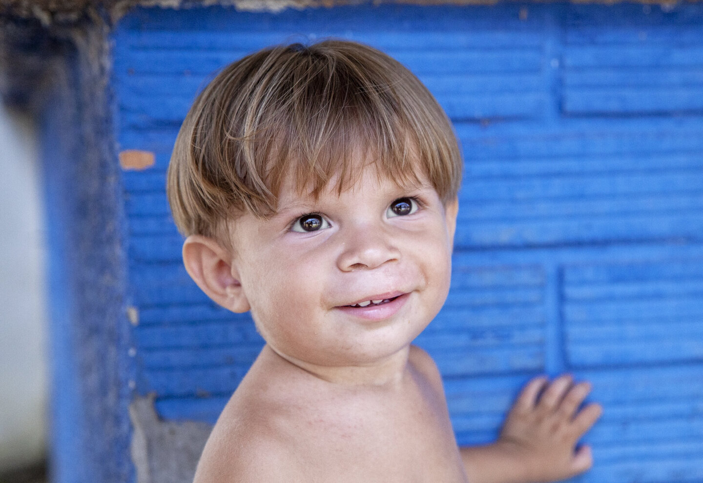 Fredy, one year after his cleft lip surgery.