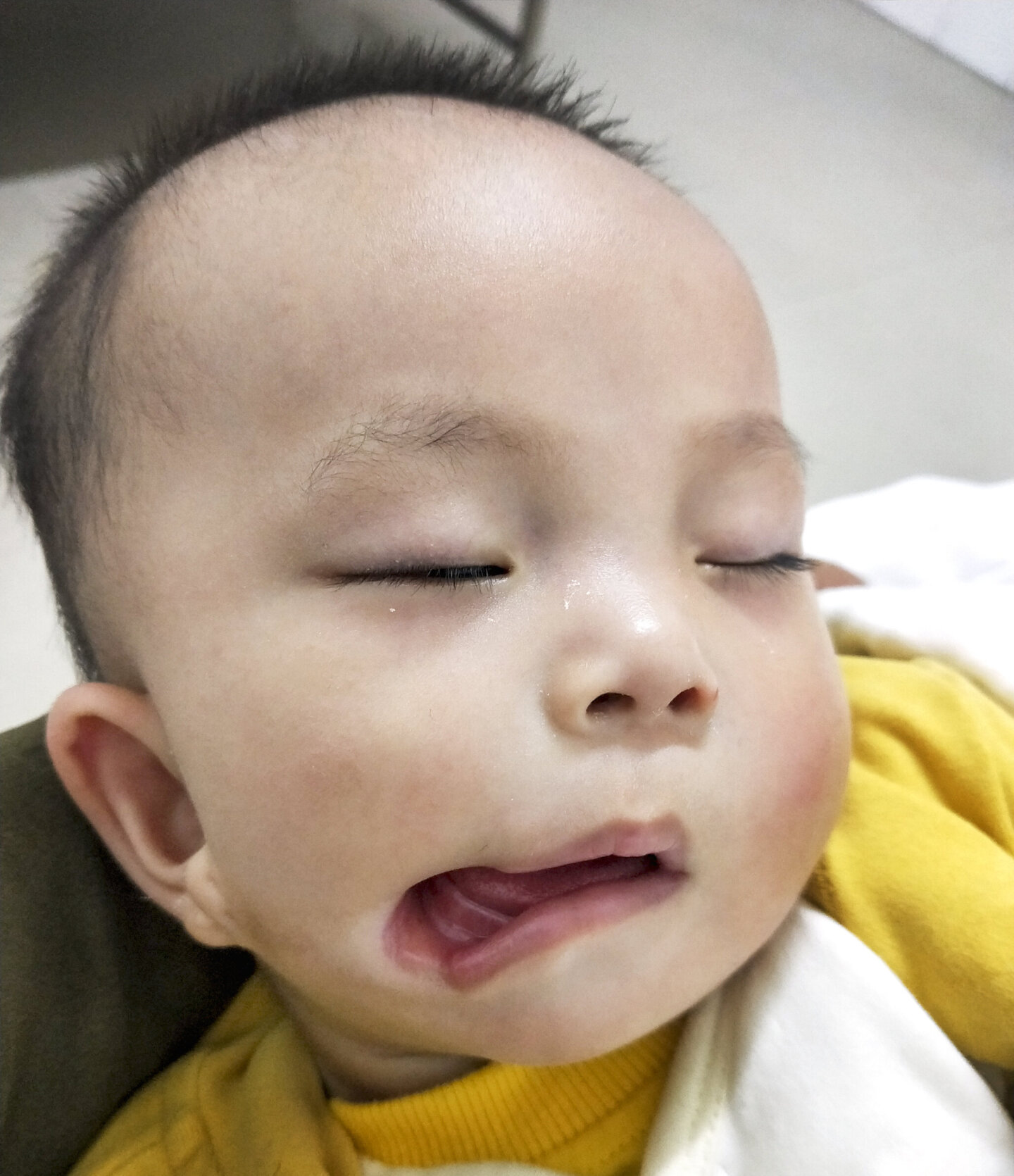 Czanczan, before surgery.