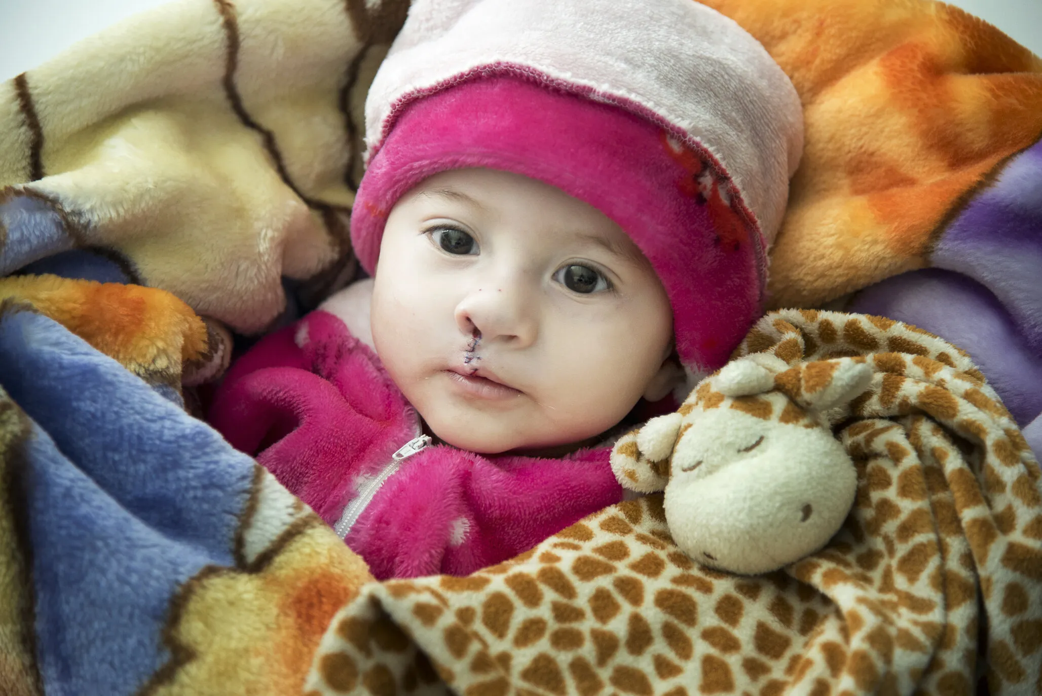 Luciana, after surgery.