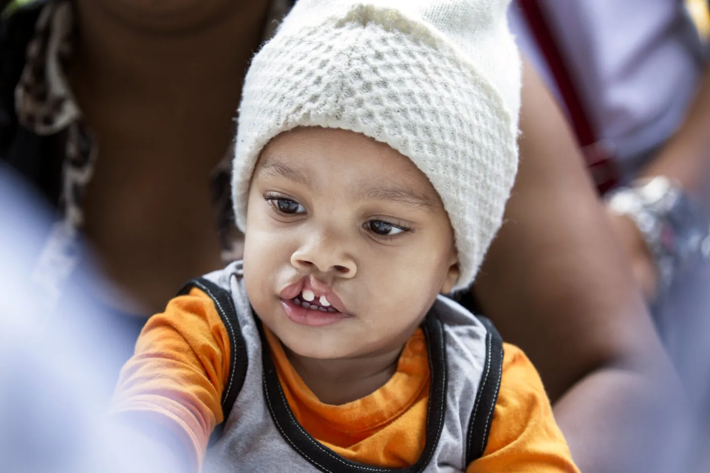 Leudy, before surgery.