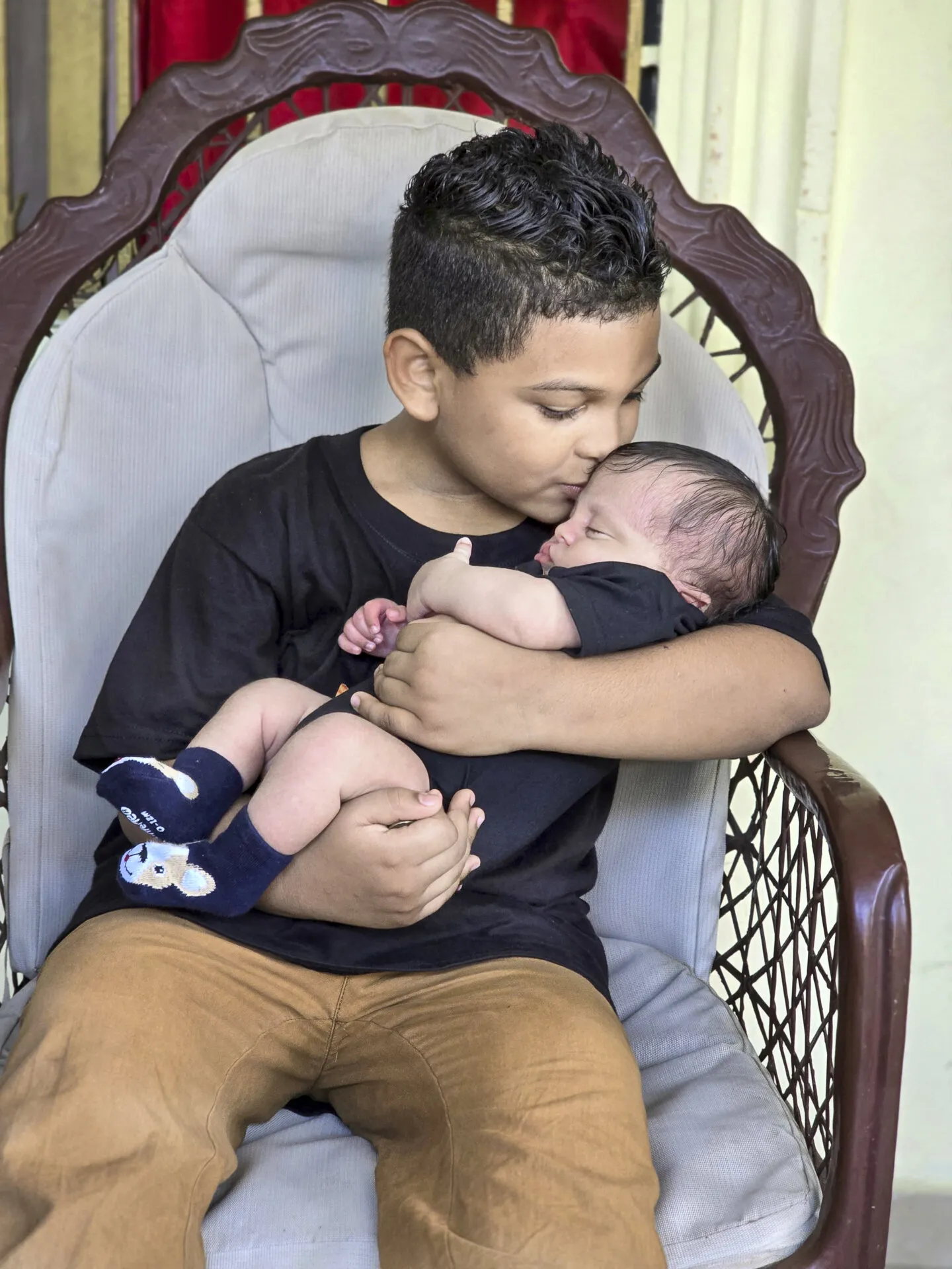 Isaac and his brother, before surgery.