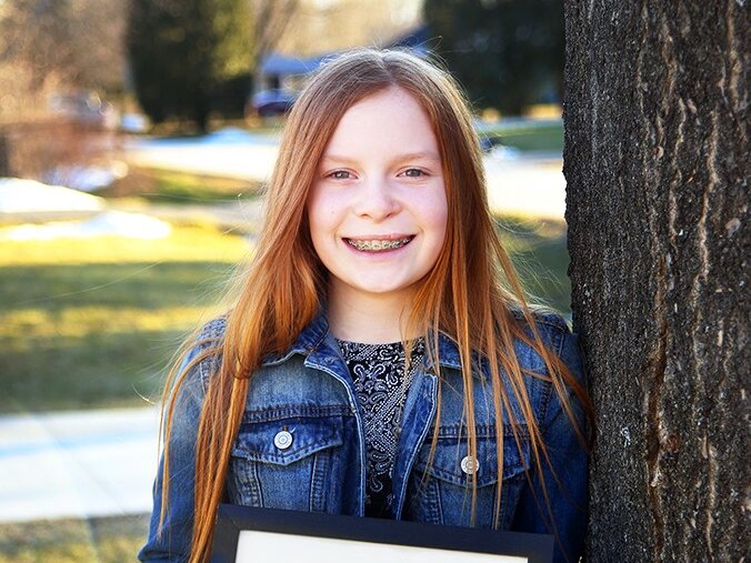 Elizabeth smiles with a photo of her as a baby, before her cleft surgery.