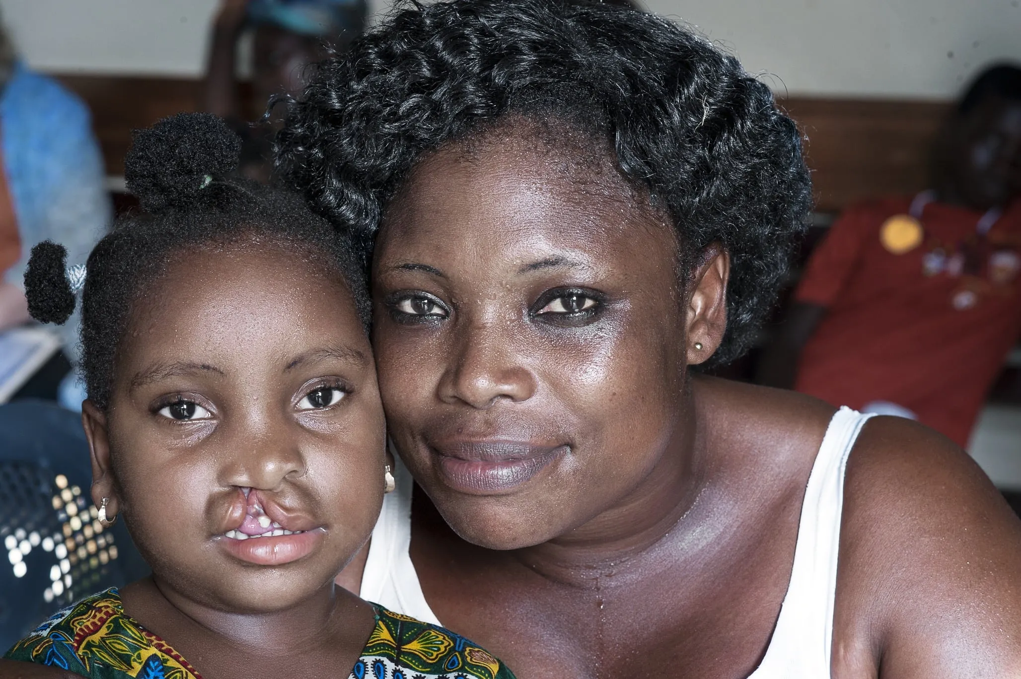 Ramata and Mariana, before Ramata's surgery.