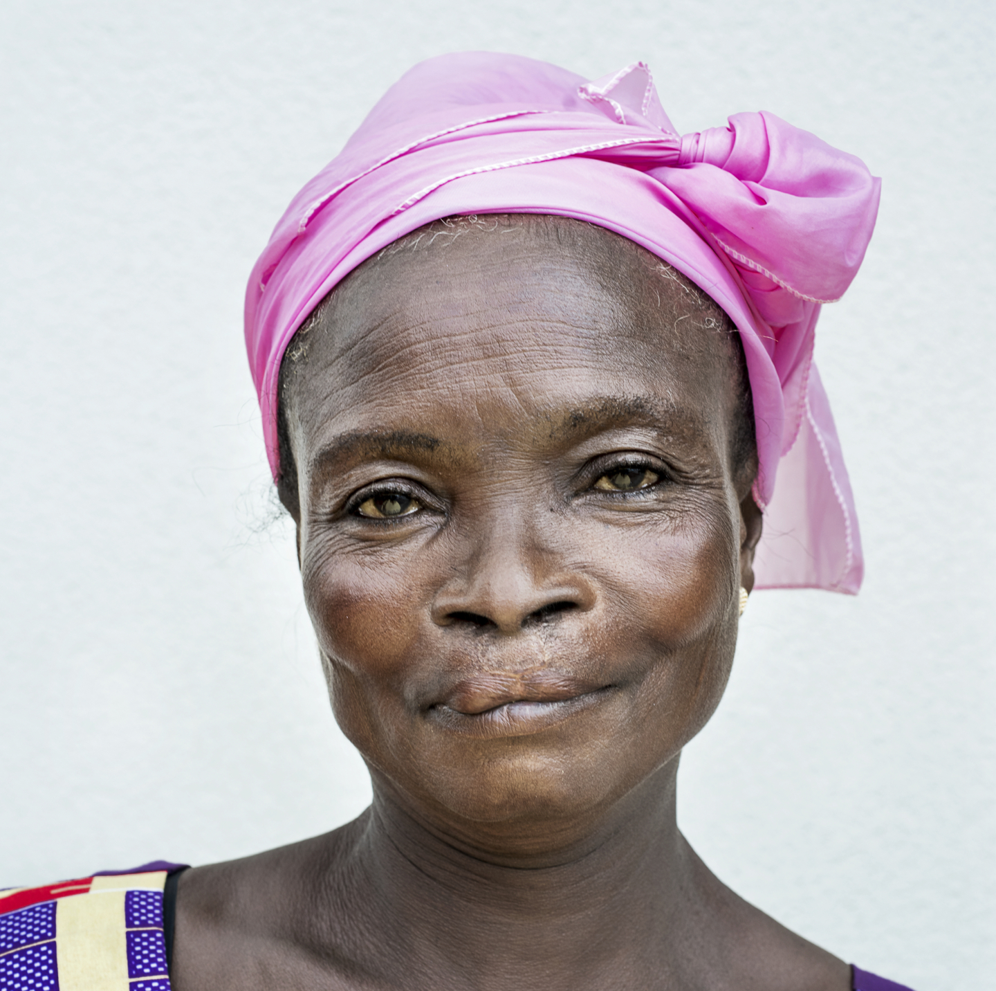 Akosua shares her new smile six months following her cleft surgery with Operation Smile Ghana.