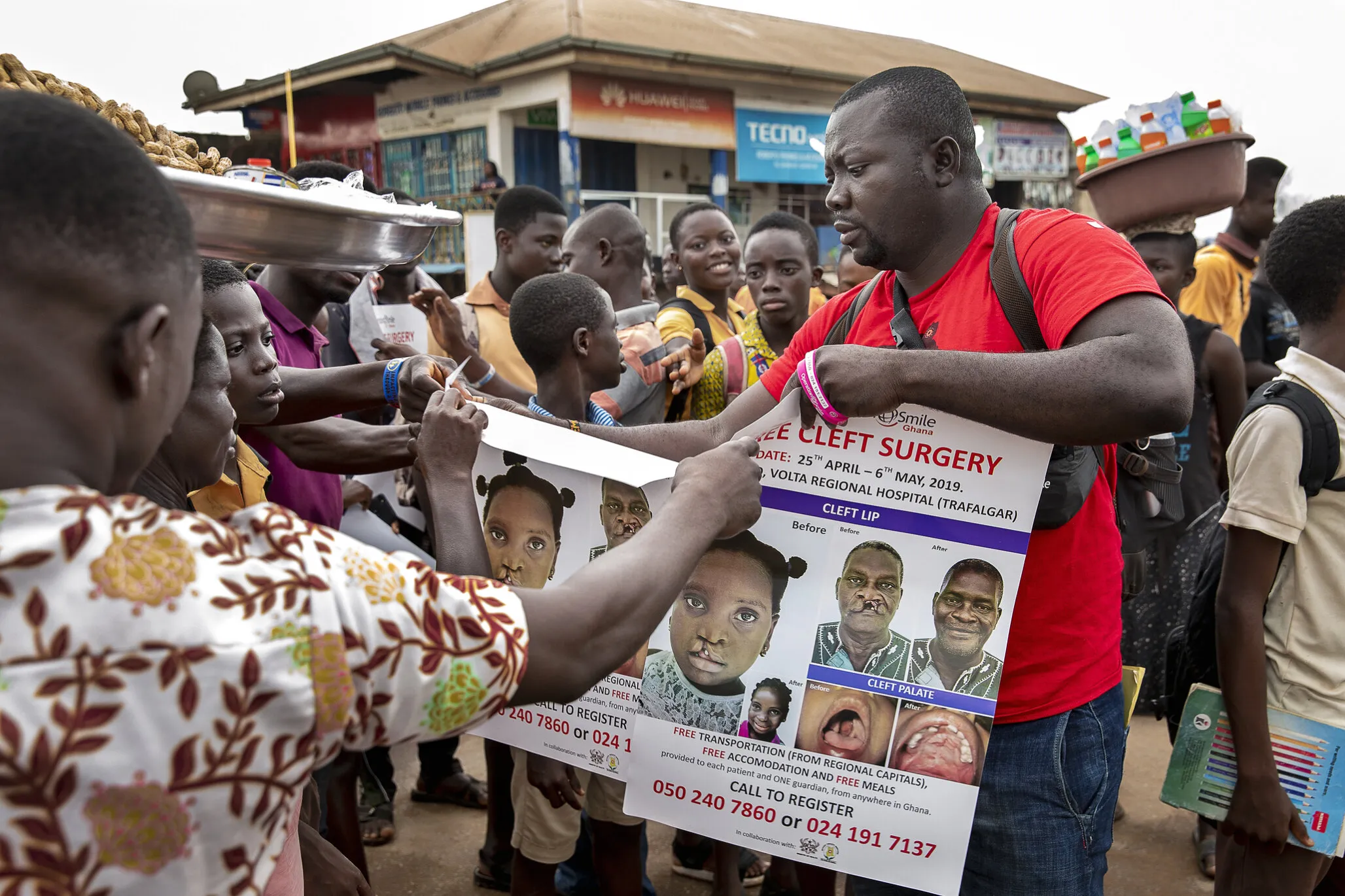 Operation Smile Ghana’s patient coordinator Clement Ofosuhemeng uses flyers and informational posters to conduct cleft awareness and patient recruitment campaigns across Ghana.