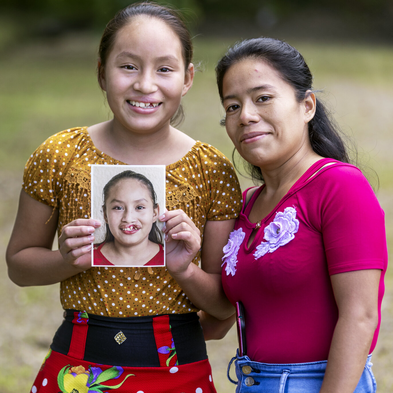 Dayana and her mom, after surgery.