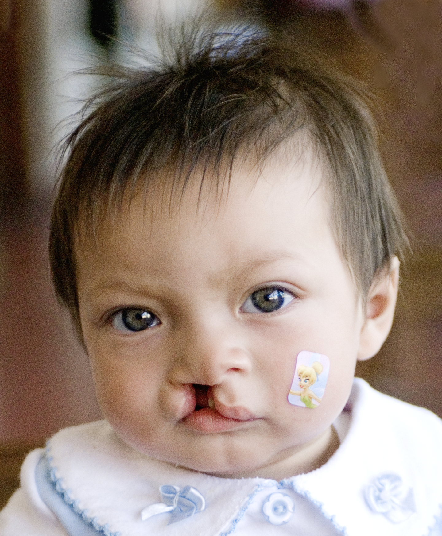 Britany at 10 months old with her mother, Cintia, before surgery at the Operation Smile Honduras care center.