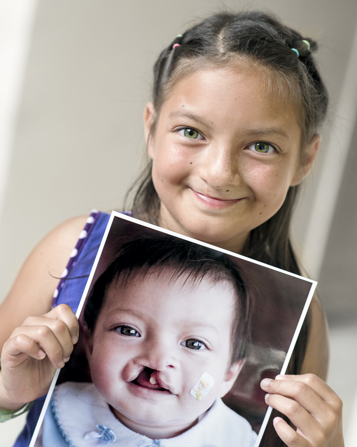 Britany at 9 years old, holding a photo of herself before her first Operation Smile surgery.