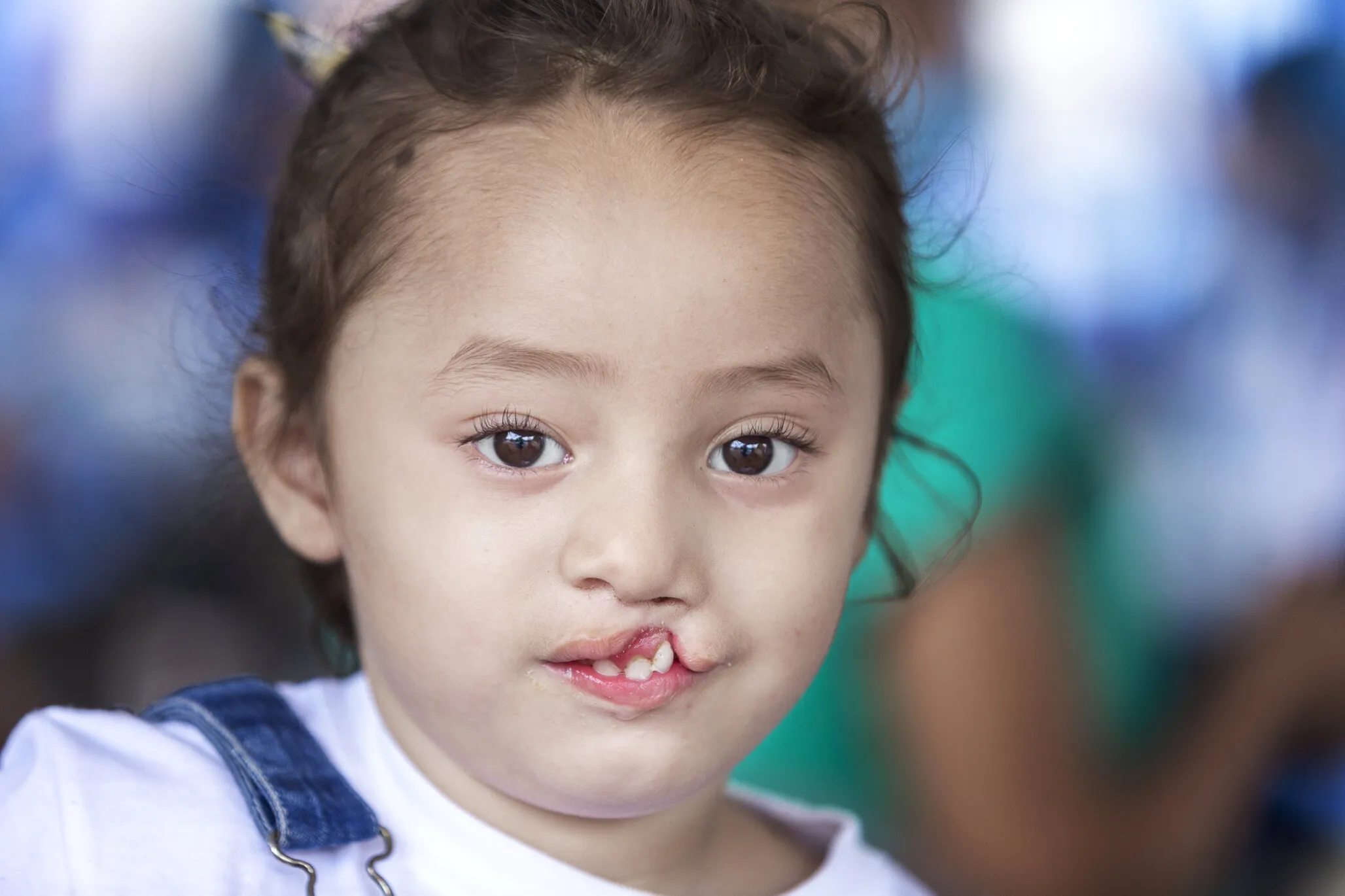 Zoe, before surgery.