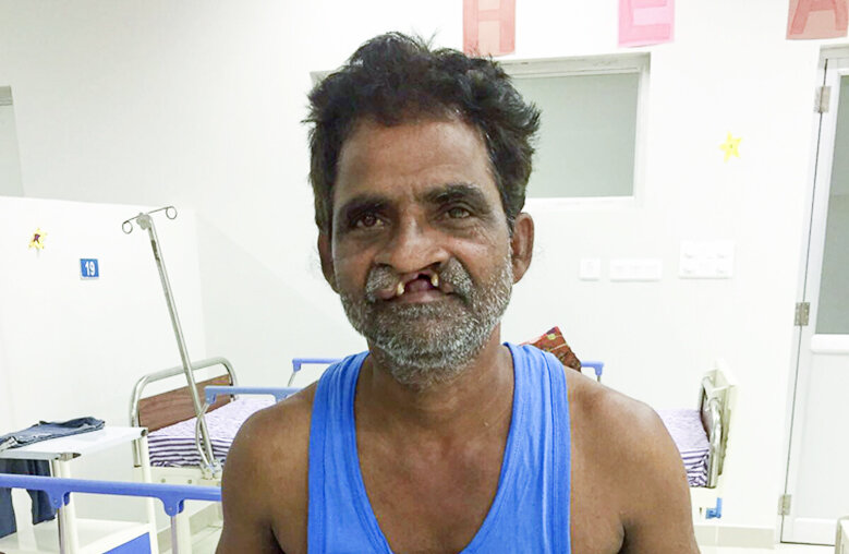 Ganesh, before surgery.