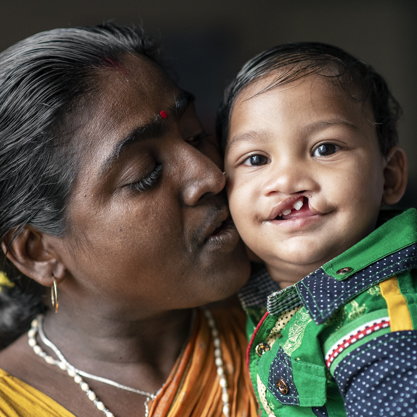 Surojit, before surgery.