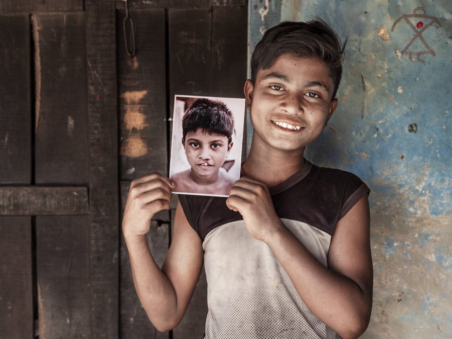 Bipul holds his before photo while smiling for the camera.