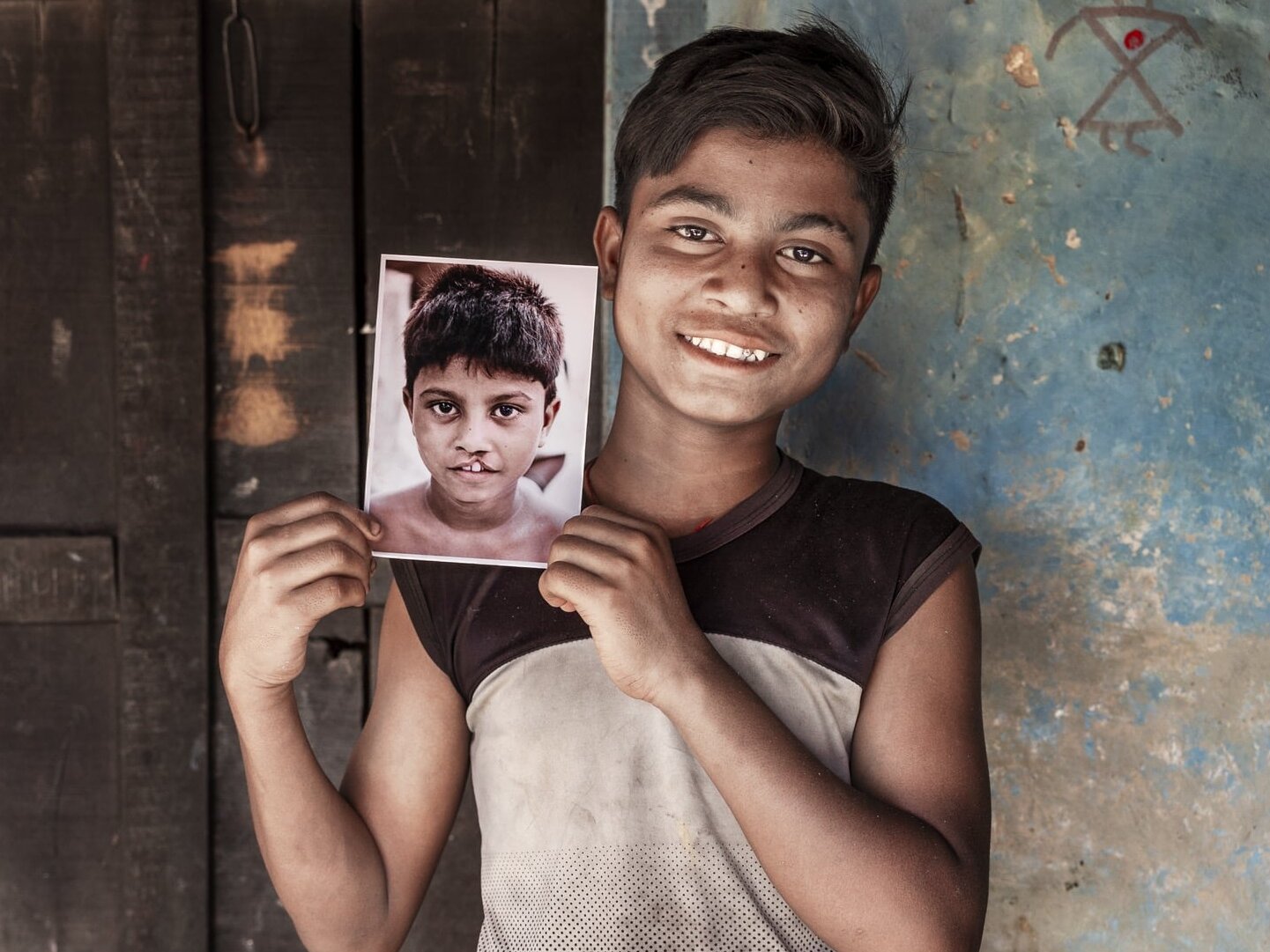 Bipul holds his before photo while smiling for the camera.
