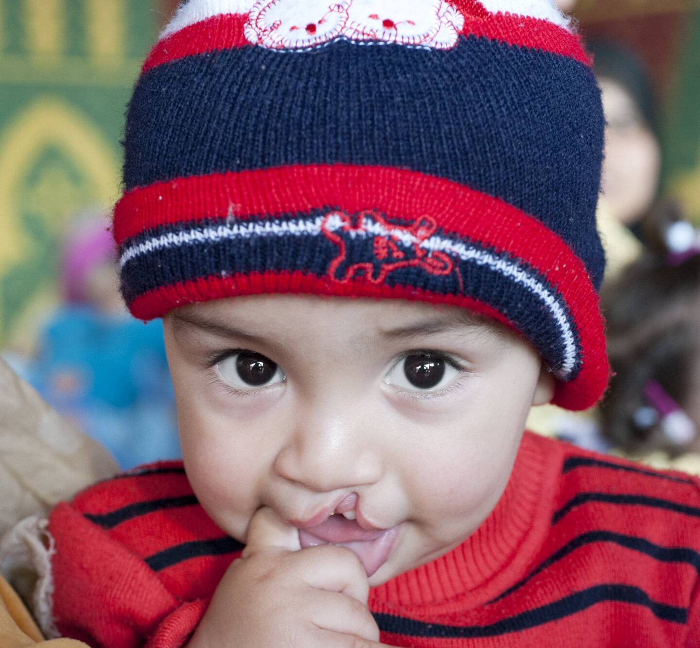 Mosslim looks at the camera during a surgical program in Morocco in 2015.