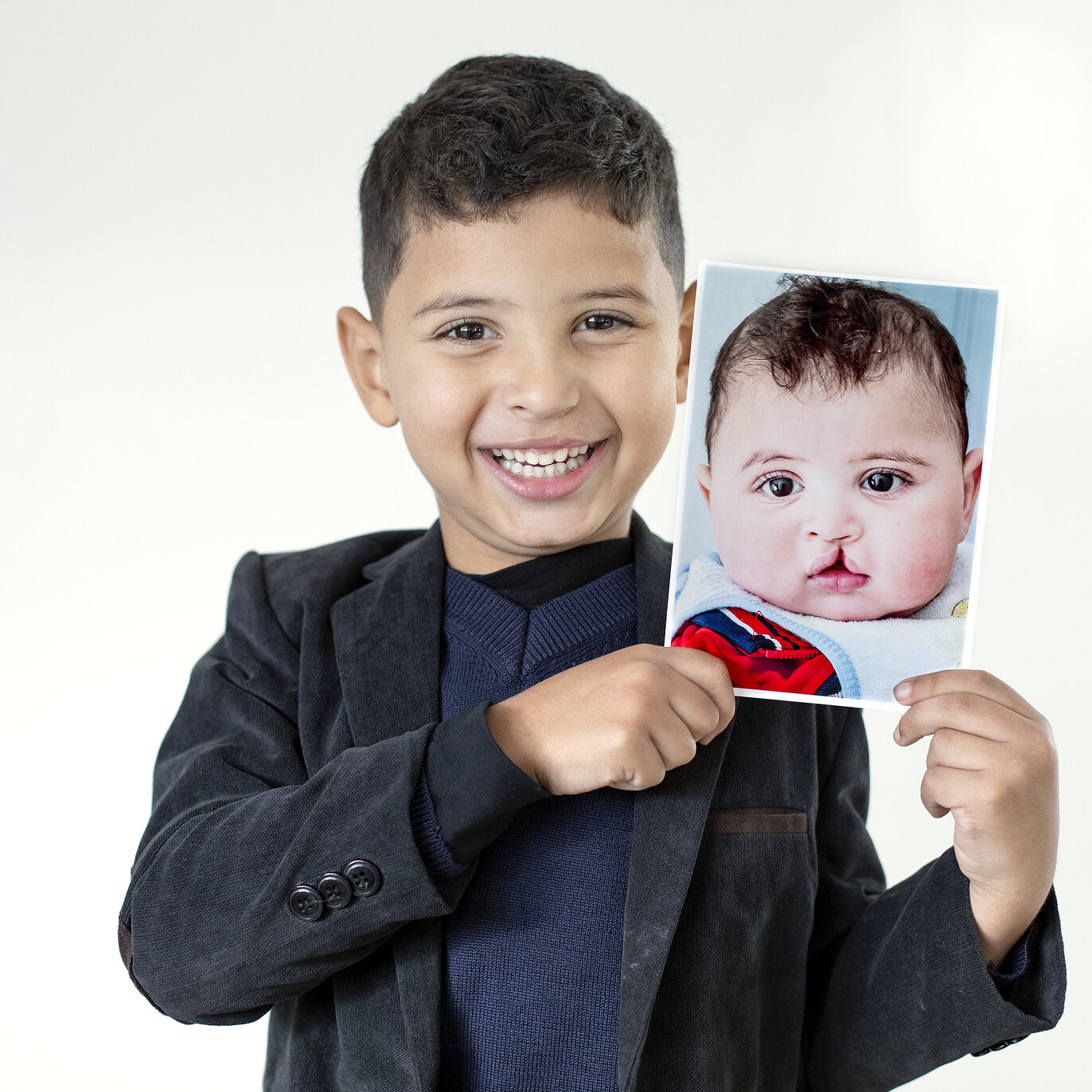 Mohamed, after surgery, holds his before photo.