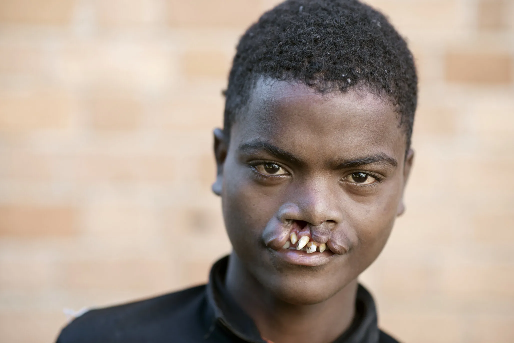 Roman, before surgery.