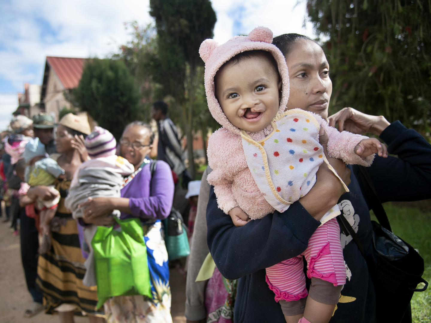 Patient announcement day has arrived in Antsirabe, and 8-month-old Suhurah is all smiles as she waits with her mother to find out if she was chosen for surgery.