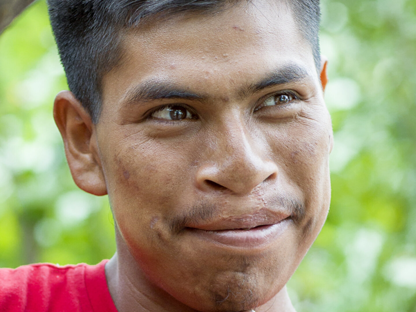 Virgilio, after surgery.
