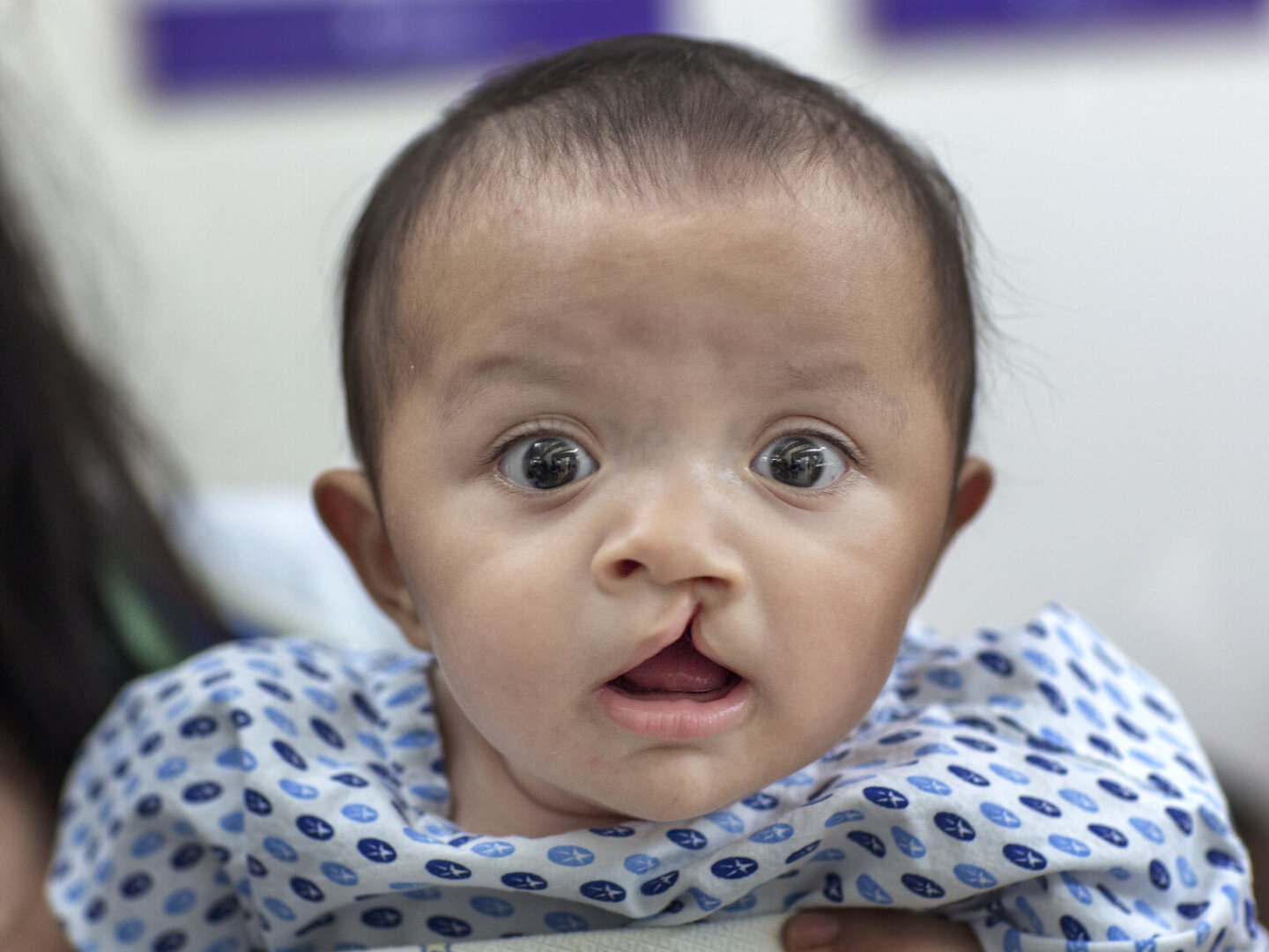 Sabine, before surgery.