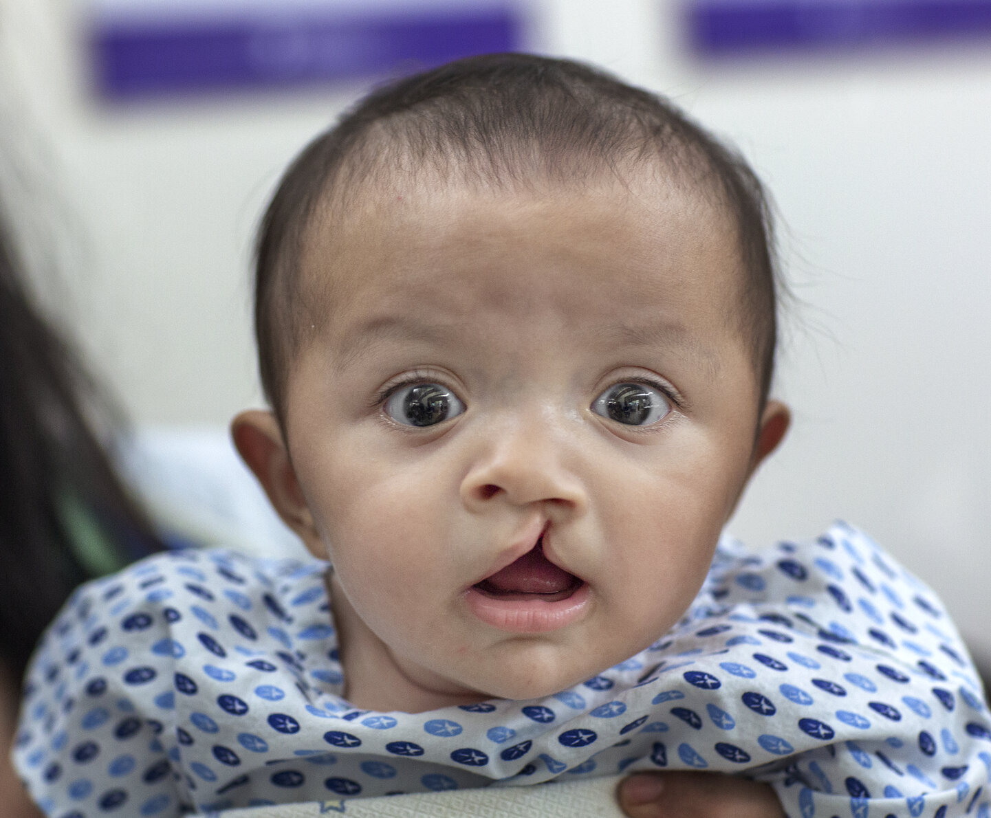 Sabine, before surgery.