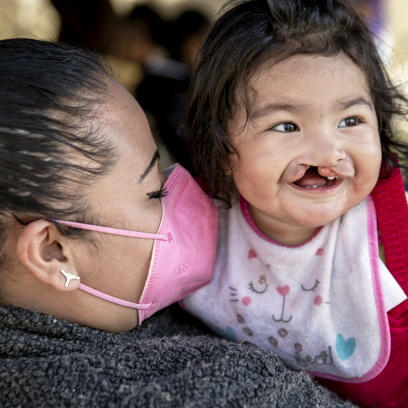 Lilia, held by her mom, Valeria, before surgery.