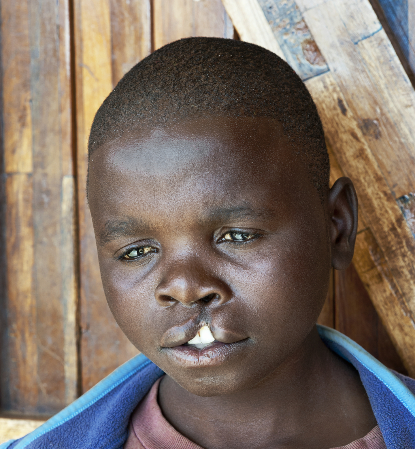 Cosmas, 21 years old.